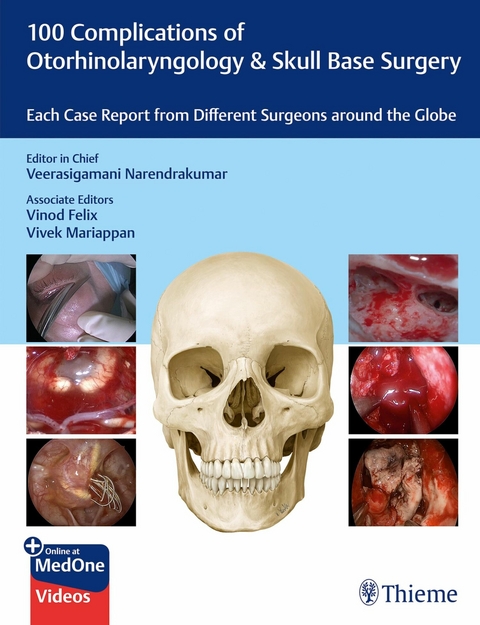 100 Complications of Otorhinolangyngology & Skull Base Surgery - 