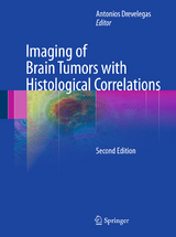 Imaging of Brain Tumors with Histological Correlations - 