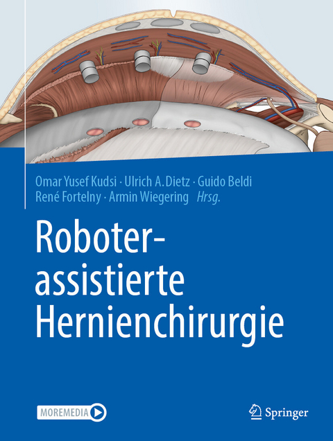 Roboterassistierte Hernienchirurgie - 