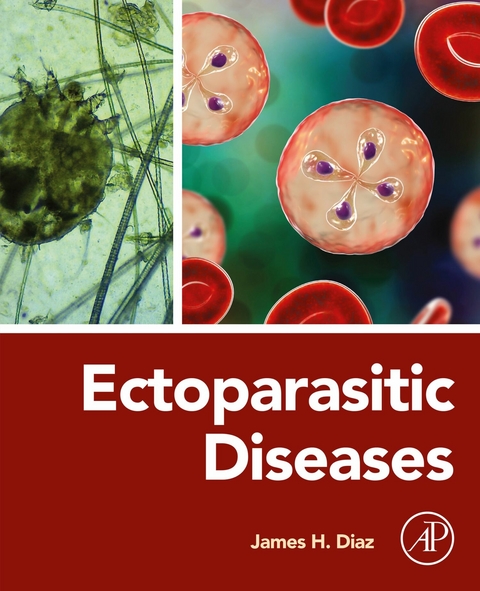 Ectoparasitic Diseases -  James H. Diaz