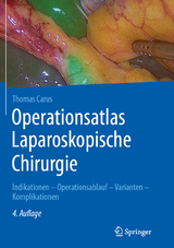 Operationsatlas Laparoskopische Chirurgie -  Thomas Carus