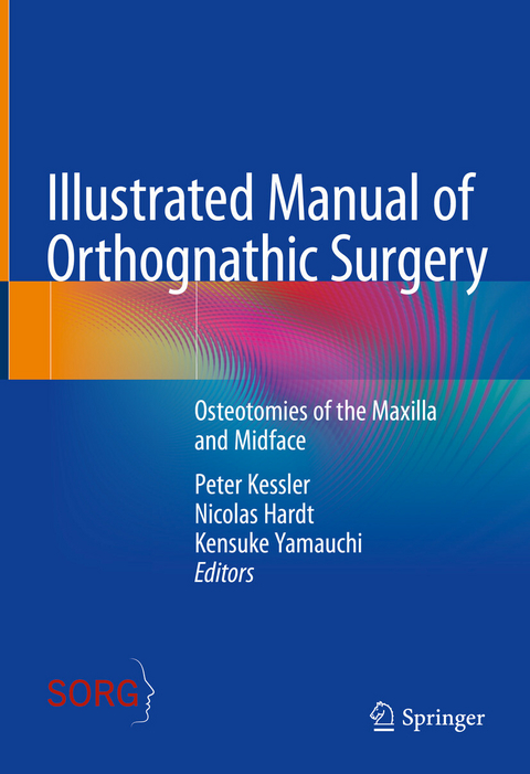 Illustrated Manual of Orthognathic Surgery - 