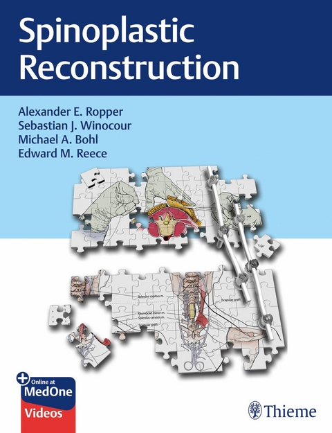 Spinoplastic Reconstruction -  Michael A Bohl,  Edward M Reece,  Alexander E. Ropper,  Sebastian J. Winocour