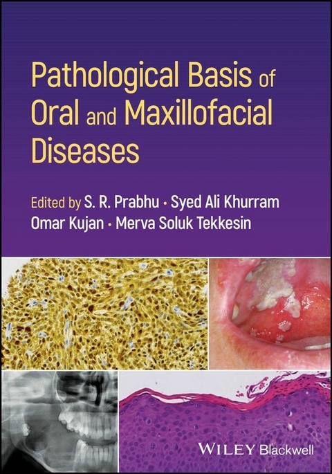 Pathological Basis of Oral and Maxillofacial Diseases - 