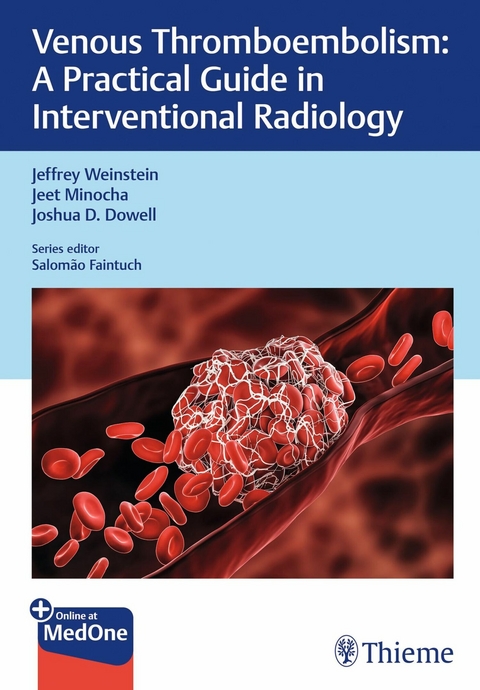 Venous Thromboembolism -  Jeffrey Weinstein,  Jeet Minocha,  Joshua Dowell