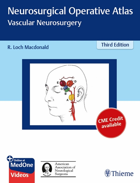 Neurosurgical Operative Atlas: Vascular Neurosurgery - 