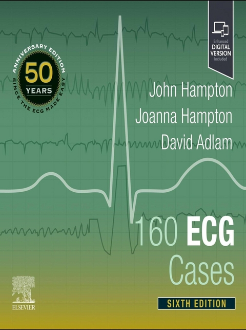 160 ECG Cases -  David Adlam,  Joanna Hampton,  John Hampton