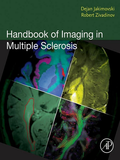 Handbook of Imaging in Multiple Sclerosis - 