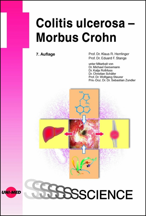 Colitis ulcerosa - Morbus Crohn -  Klaus R. Herrlinger,  Eduard F. Stange