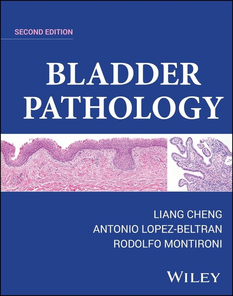 Bladder Pathology - Liang Cheng, Antonio Lopez-Beltran, Rodolfo Montironi