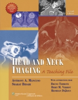 Head and Neck Imaging - Mancuso, Anthony A.; Bidari, Sharat; Termote, Bruno; Verbist, Berit M.; DeJesus, Reordan