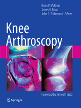 Knee Arthroscopy - 