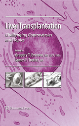 Liver Transplantation - 