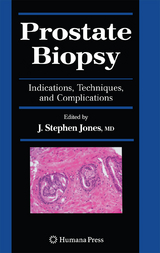 Prostate Biopsy - 