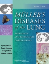 Muller's Diseases of the Lung - Lee, Kyung Soo; Franquet, Tomás; Han, Dr. Joungho; Johkoh, Takeshi