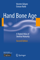 Hand Bone Age - Vicente Gilsanz, Osman Ratib