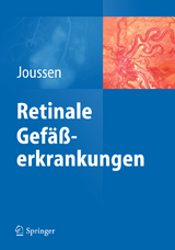 Retinale Gefäßerkrankungen - 