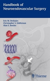 Handbook of Neuroendovascular Surgery - 