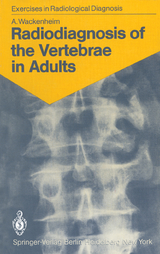 Radiodiagnosis of the Vertebrae in Adults - Auguste Wackenheim