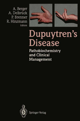 Dupuytren’s Disease - 