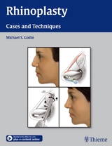 Rhinoplasty - Michael S. Godin