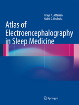 Atlas of Electroencephalography in Sleep Medicine - Hrayr P. Attarian, Nidhi S Undevia