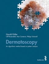 Dermatoscopy - Harald Kittler, Cliff Rosendahl, Alan Cameron, Philipp Tschandl