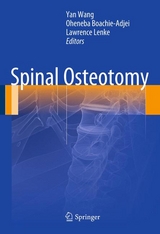 Spinal Osteotomy - 