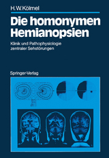 Die homonymen Hemianopsien - Hans W. Kölmel