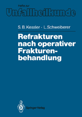 Refrakturen nach operativer Frakturenbehandlung - Sigurd B. Kessler, Leonhard Schweiberer