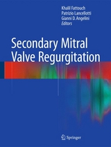 Secondary Mitral Valve Regurgitation - 