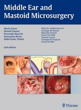 Middle Ear and Mastoid Microsurgery - Hiroshi Sunose, Alessandra Russo, Abdelkader Taibah, Fernando Mancini, Mario Sanna