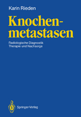 Knochenmetastasen - Karin Rieden