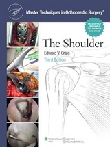 Master Techniques in Orthopaedic Surgery: Shoulder - Craig, Edward V