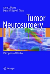 Tumor Neurosurgery - 