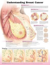 Understanding Breast Cancer 3E Laminated - 