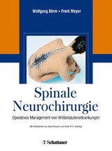 Spinale Neurochirurgie - Wolfgang Börm