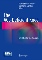 The ACL-Deficient Knee - 