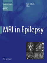 MRI in Epilepsy - 