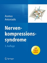 Nervenkompressionssyndrome - 