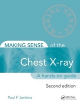 Making Sense of the Chest X-ray - Jenkins, Paul