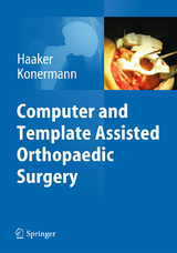 Computer and Template Assisted Orthopedic Surgery - 