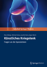 Künstliches Kniegelenk - Peter Aldinger, Joachim Herre, Michael Clarius, Martin Juergen