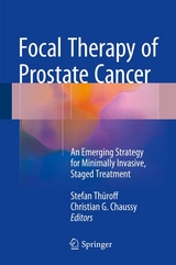 Focal Therapy of Prostate Cancer - 