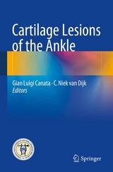 Cartilage Lesions of the Ankle - 