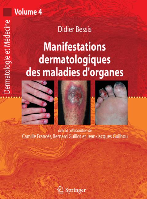 Manifestations Dermatologiques Des Maladies D'Organes