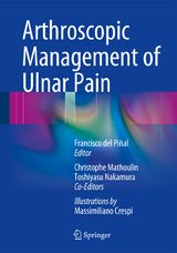 Arthroscopic Management of Ulnar Pain - 