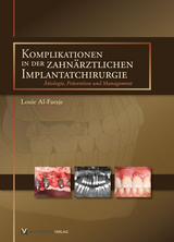 Komplikationen in der zahnärztlichen Implantatchirurgie - Louie Al-Faraje