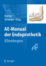 AE-Manual der Endoprothetik - 