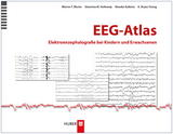 EEG–Atlas - Warren T. Blume, Giannina M. Holloway, Masako Kaibara, G. Bryan Young